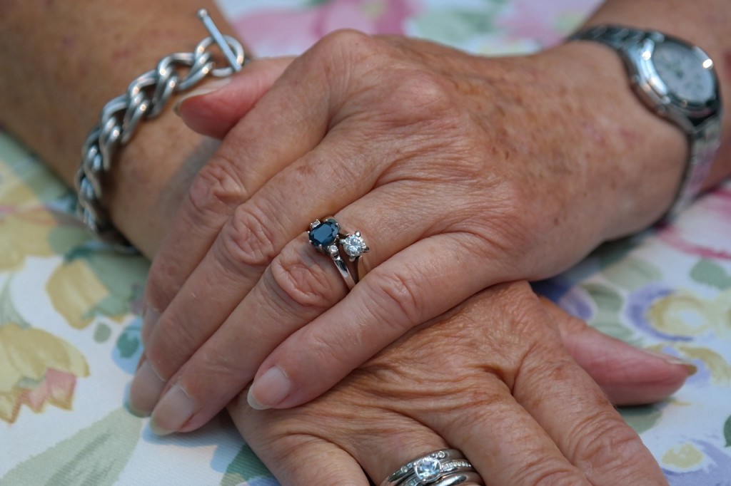 Woman's hands with wrinkles and jewelry reveal skin issues