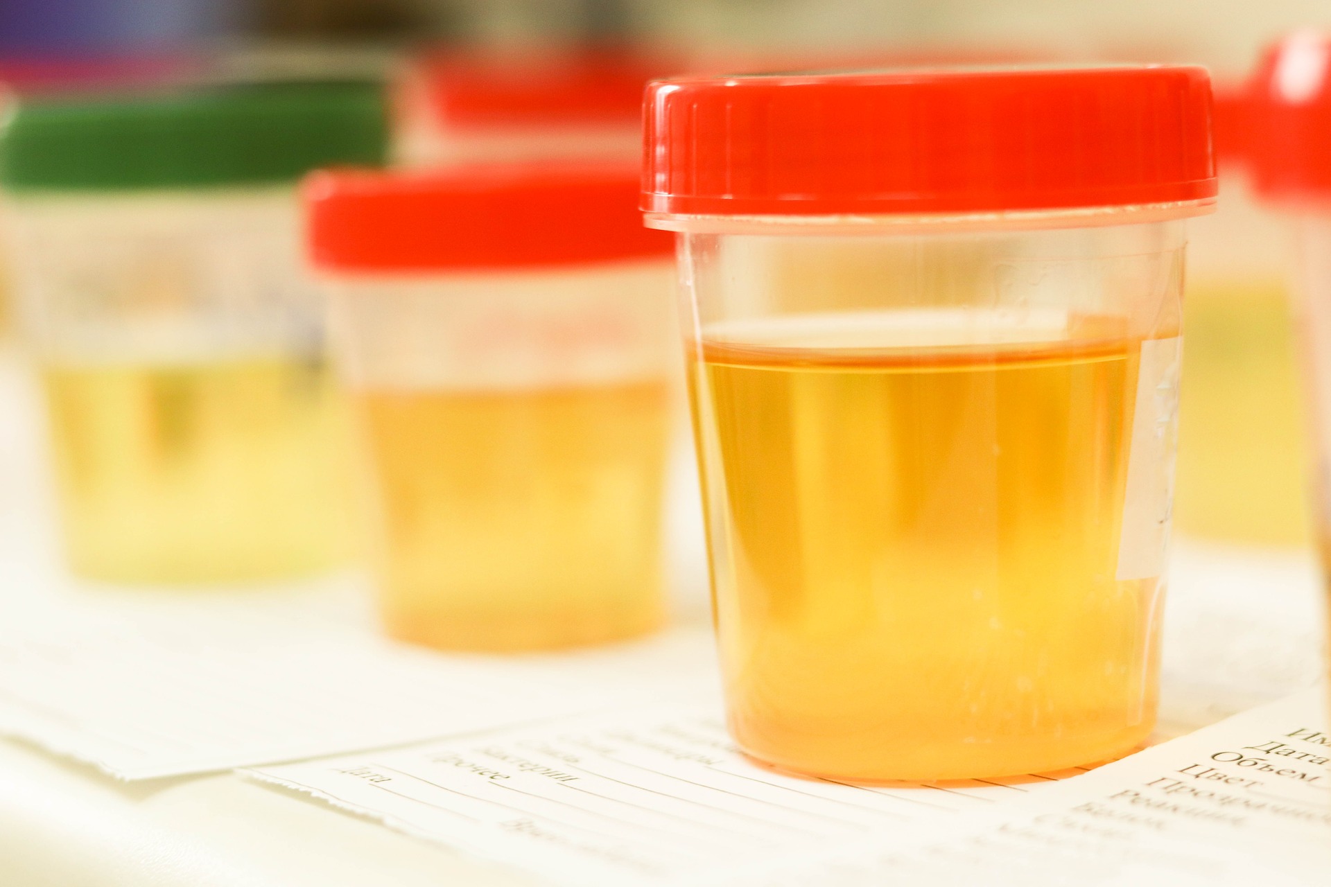 Urine samples in clear cups with red lids from random drug testing program